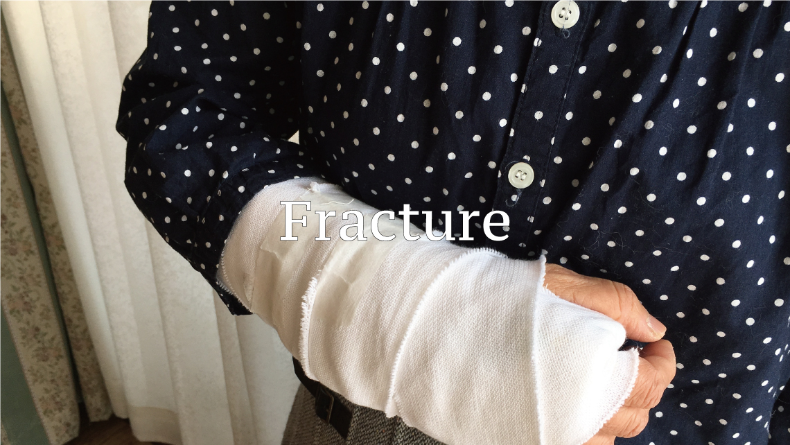 fracture